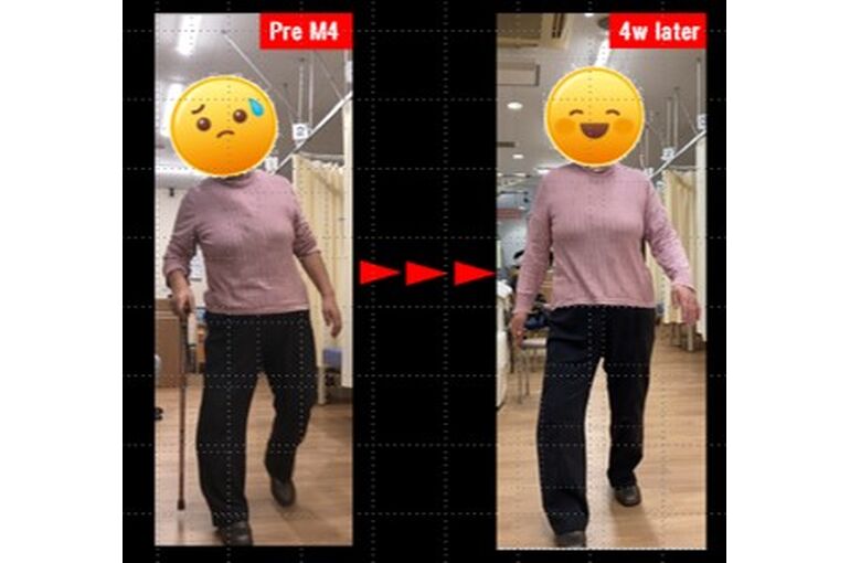 ビフォーアフターの画像