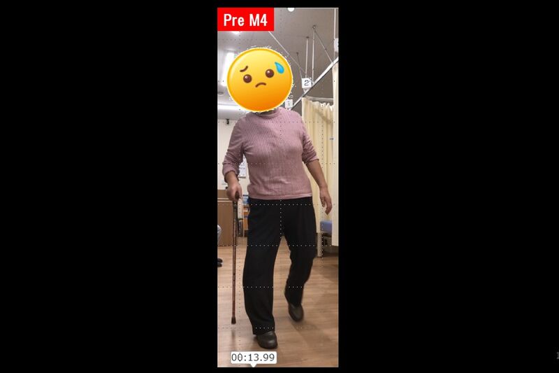 ビフォーアフター