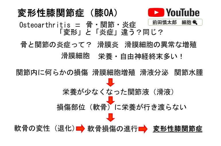 関節炎から変形性膝関節症までのメカニズム