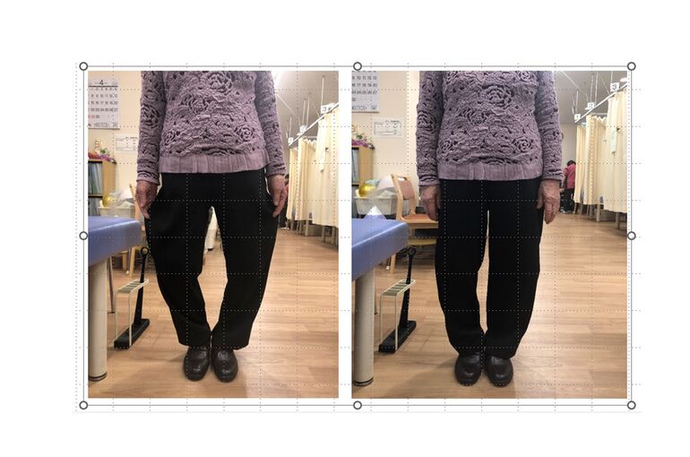 施術前後の写真