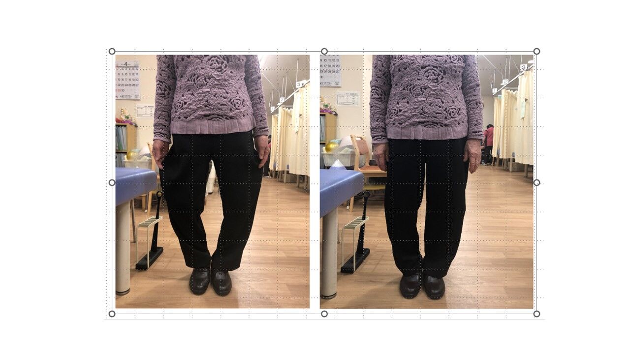 before and after 2