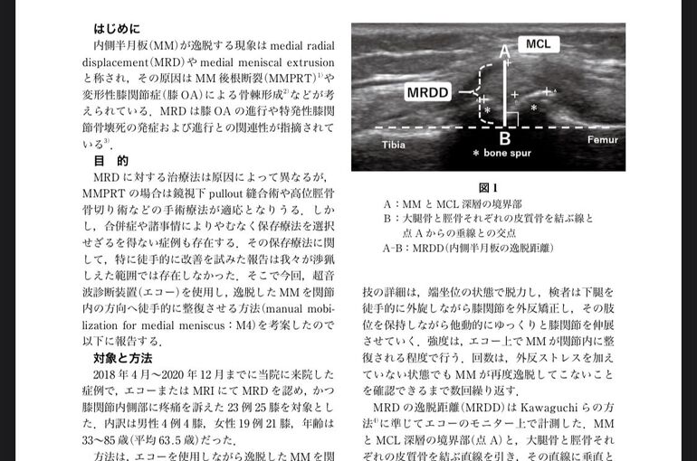 M4　逸脱した半月板に対する徒手療法